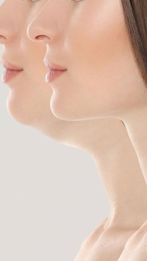 RF CHUBBY / DOUBLECHIN